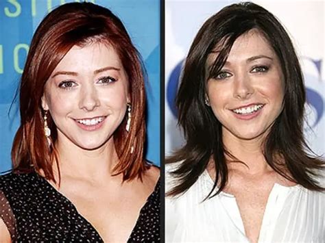 alyson hannigan plastic surgery